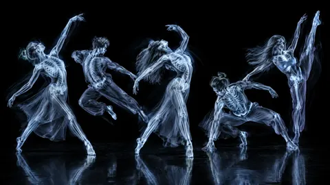 Five X-Ray Dancers
