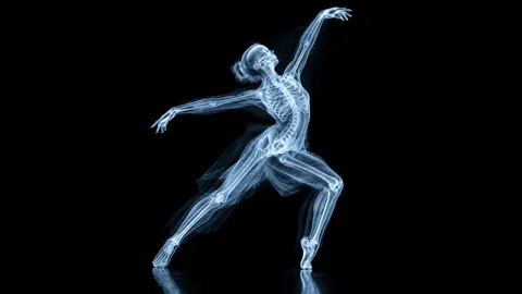 X-Ray Dancer on Black